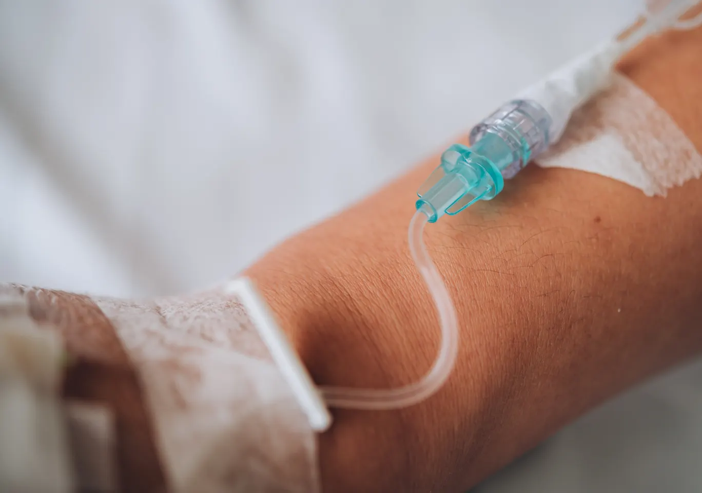Kroplówki witaminowe Hajnówka: wenflon oklejony na przedramieniu podczas wlewu